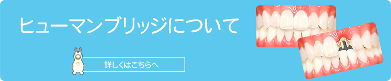 浦添の歯医者「サンエー経塚シティオレンジ歯科」の診療メニュー、ヒューマンブリッジについて